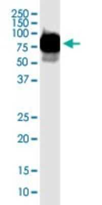 Western Blot: T Plastin Antibody (5B9) [H00005358-M01]