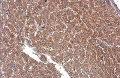 Immunohistochemistry-Paraffin: T Plastin Antibody (GT236) [NBP3-13517]