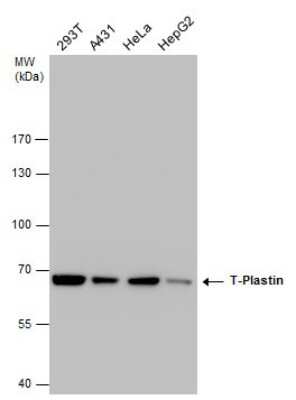Western Blot: T Plastin Antibody (GT236) [NBP3-13517]