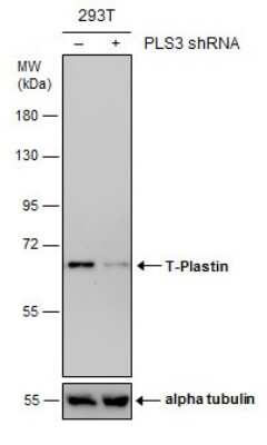 Western Blot: T Plastin Antibody (GT236) [NBP3-13517]