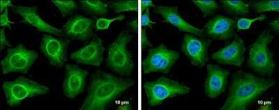 Immunocytochemistry/ Immunofluorescence: T Plastin Antibody (GT3310) [NBP3-13518]