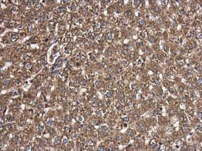 Immunohistochemistry-Paraffin: T Plastin Antibody (GT3310) [NBP3-13518]