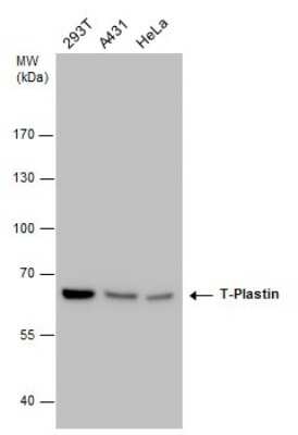 Western Blot: T Plastin Antibody (GT3310) [NBP3-13518]