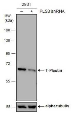 Western Blot: T Plastin Antibody (GT3310) [NBP3-13518]