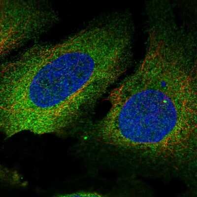 Immunocytochemistry/ Immunofluorescence: T Plastin Antibody [NBP2-55895]