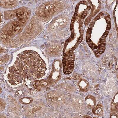 Immunohistochemistry-Paraffin: T Plastin Antibody [NBP2-13778]