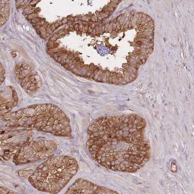 Immunohistochemistry-Paraffin: T Plastin Antibody [NBP2-13778]