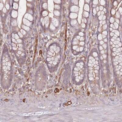 Immunohistochemistry-Paraffin: T Plastin Antibody [NBP2-13778]