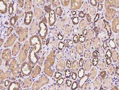 Immunohistochemistry-Paraffin: T Plastin Antibody [NBP3-06608]