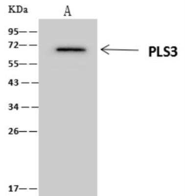 Immunoprecipitation: T Plastin Antibody [NBP3-06608]