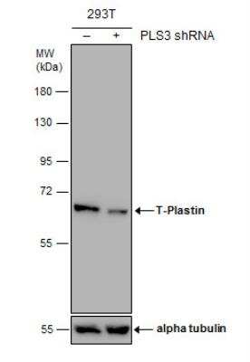 Western Blot: T Plastin Antibody [NBP1-32380]