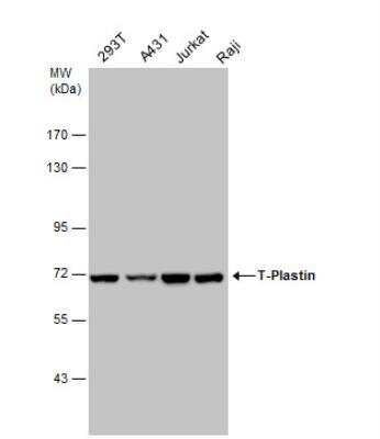 Western Blot: T Plastin Antibody [NBP1-32380]