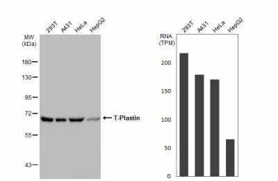 Western Blot: T Plastin Antibody [NBP1-32380]