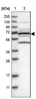 Western Blot: T Plastin Antibody [NBP2-13778]