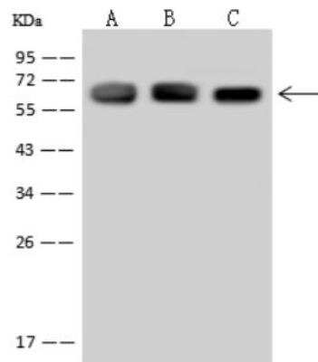 Western Blot: T Plastin Antibody [NBP3-06608]