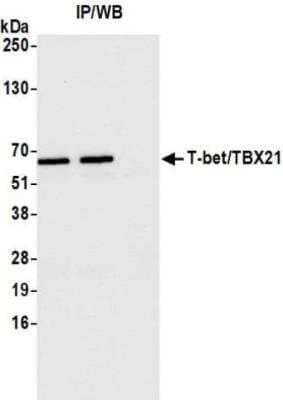 Immunoprecipitation: T-bet/TBX21 Antibody (BLR110H) [NBP3-14699]