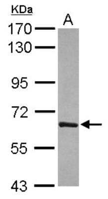 Western Blot: T-bet/TBX21 Antibody [NBP2-20583]