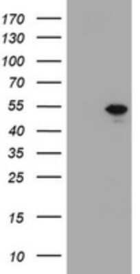 Western Blot: T-box 19 Antibody (OTI1C9) [NBP2-46077]