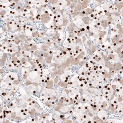 Immunohistochemistry-Paraffin: T-box 19 Antibody (CL6251) [NBP2-61438]