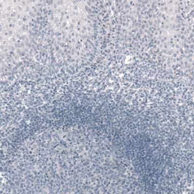 Immunohistochemistry-Paraffin: T-box 19 Antibody (CL6251) [NBP2-61438]