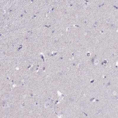 Immunohistochemistry-Paraffin: T-box 19 Antibody [NBP2-68943]