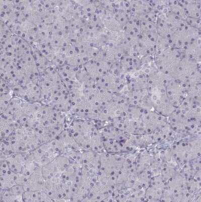 Immunohistochemistry-Paraffin: T-box 19 Antibody [NBP2-68943]
