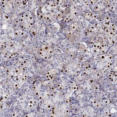 Immunohistochemistry-Paraffin: T-box 19 Antibody [NBP2-68943]