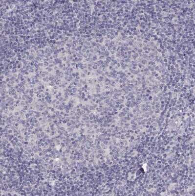 Immunohistochemistry-Paraffin: T-box 19 Antibody [NBP2-68943]