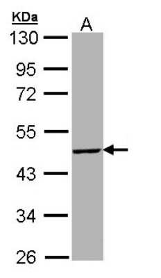 Western Blot: T-box 19 Antibody [NBP1-32878]