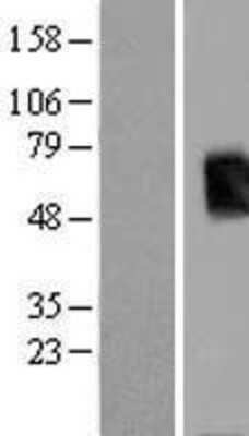 Western Blot: T-box 19 Overexpression Lysate [NBL1-16745]