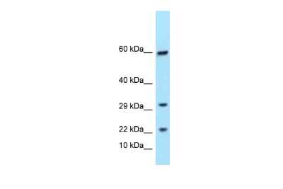 Western Blot: TRGC1 Antibody [NBP3-09399]