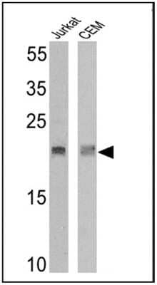 Western Blot: TCR V delta 2 Antibody (15D) [NBP2-22508]