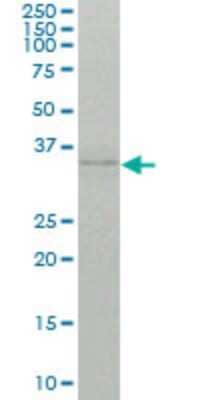 Western Blot: TCR V delta Antibody (2H6) [H00006964-M01]