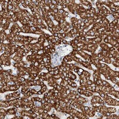 Immunohistochemistry-Paraffin: T2R60 Antibody [NBP1-86975]