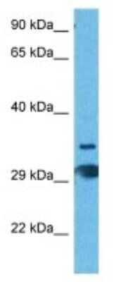 Western Blot: T2R60 Antibody [NBP3-10219]