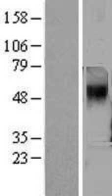 Western Blot: TAAR5 Overexpression Lysate [NBL1-16664]