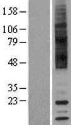 Western Blot: TAAR9 Overexpression Lysate [NBP2-04436]