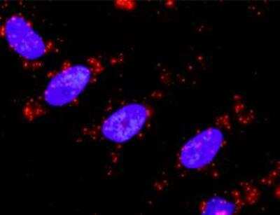 Proximity Ligation Assay: TAB1 Antibody (2A12) [H00010454-M03]