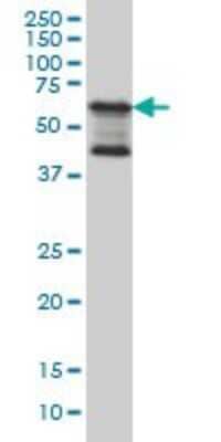 Western Blot: TAB1 Antibody (2A12) [H00010454-M03]