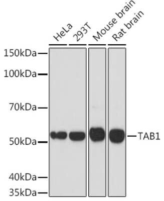 Western Blot: TAB1 Antibody (2W0P2) [NBP3-16167]