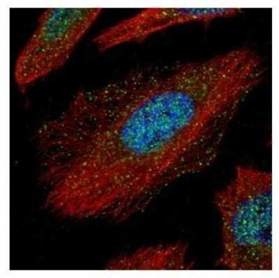Immunocytochemistry/ Immunofluorescence: TAB1 Antibody [NBP2-20552]