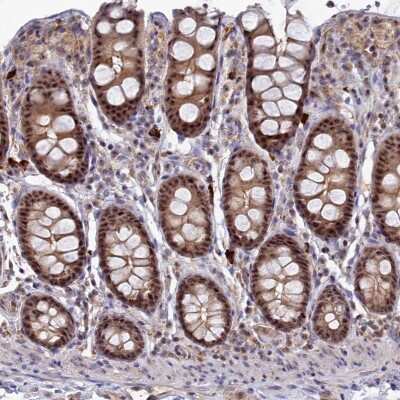 Immunohistochemistry-Paraffin: TAB1 Antibody [NBP2-38458]