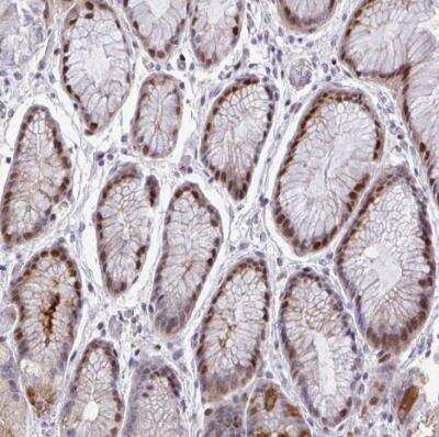 Immunohistochemistry-Paraffin: TAB1 Antibody [NBP2-38819]