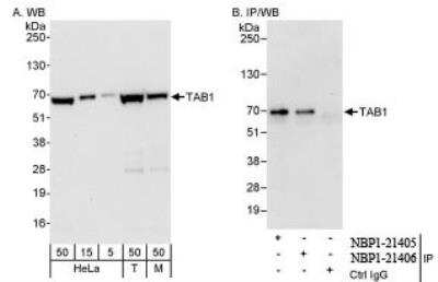 Western Blot: TAB1 Antibody [NBP1-21405]