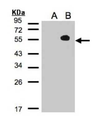 Western Blot: TAB1 Antibody [NBP2-20552]