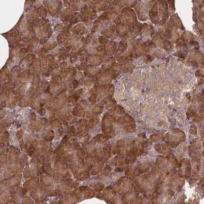 Immunohistochemistry-Paraffin: TAB2 Antibody [NBP2-68833]