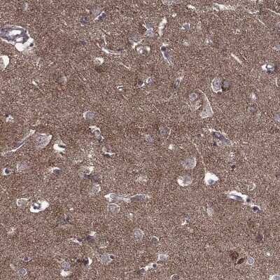 Immunohistochemistry: TAB2 Antibody [NBP2-68895]