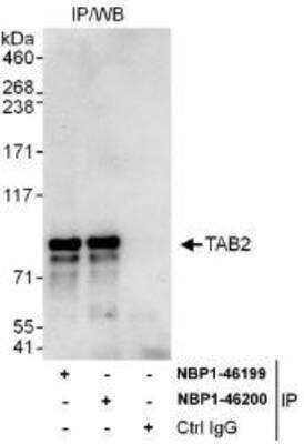 Immunoprecipitation: TAB2 Antibody [NBP1-46199]