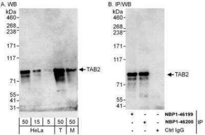 Western Blot: TAB2 Antibody [NBP1-46200]