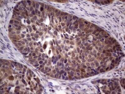 Immunohistochemistry: TACC1 Antibody (OTI1H2) [NBP2-46057]